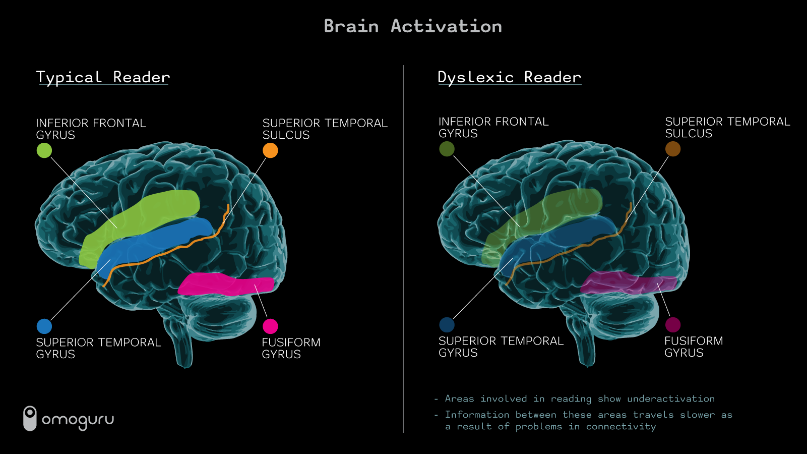 Areas Of Brain Activation In Males And Females During